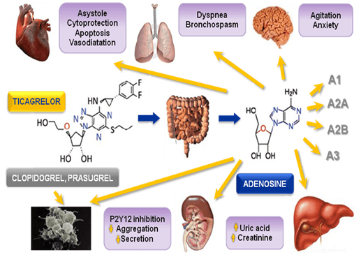 Sơ đồ minh họa Caffeine ngăn chặn thụ thể Adenosine, gây tỉnh táo và có thể dẫn đến mất ngủ.